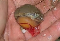 انکیباتور - علائم کالبد گشایی عفونت کیسه زرده جوجه