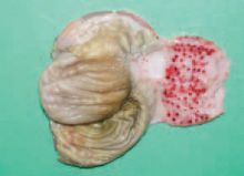 بیماری معده و سنگدان در مرغداری